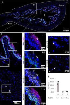 Spatial mapping of ectonucleotidase gene expression in the murine urinary bladder